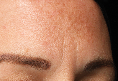 Résultats avant application